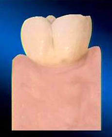 Модель зуба