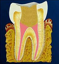 Пломбирование корневых каналов зуба
